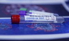 YAP-ın qurultay nümayəndələrindən koronavirus testi götürülür