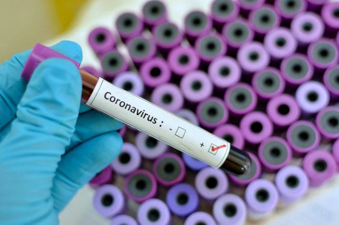 Gürcüstanda koronavirusa yoluxanların sayı 931 nəfərə çatıb