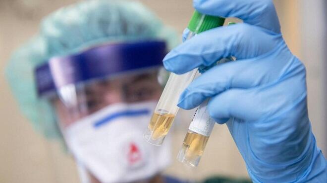 Qırğızıstanda daha 314 nəfər koronavirusa yoluxub, 4 nəfər vəfat edib