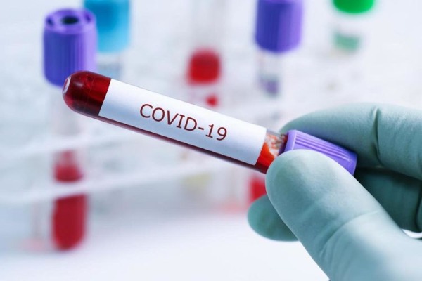 Azərbaycanda indiyədək 2 726 470 koronavirus testi aparılıb
