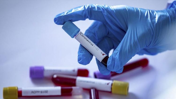 Britaniyada daha 847 nəfər koronavirusdan ölüb