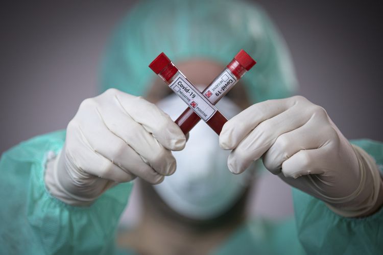Rusiyada son sutkada 181 nəfərin koronavirusdan ölüb