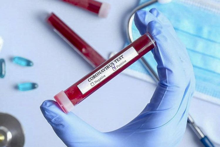 Azərbaycanda indiyədək 610 523 koronavirus testi aparılıb
