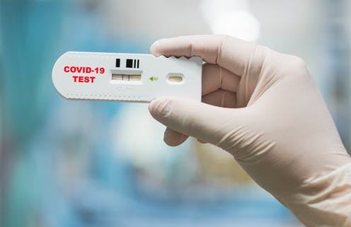 Koronavirus xəstələrindən götürülən testin həssaslığı 100 faiz deyil - Nazirlik