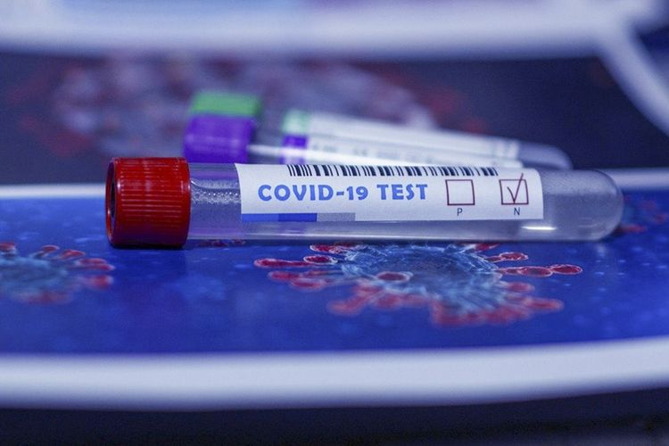 YAP-ın qurultay nümayəndələrindən koronavirus testi götürülür