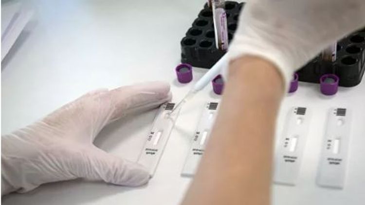 Penitensiar müəssisələrdə saxlanılan şəxslərin test nümunələri götürələrək laborator analizlərin aparılması təşkil olunub