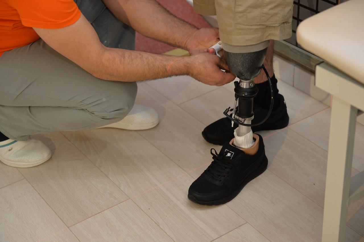 10 qaziyə yüksək texnologiyalı protez təqdim olunub