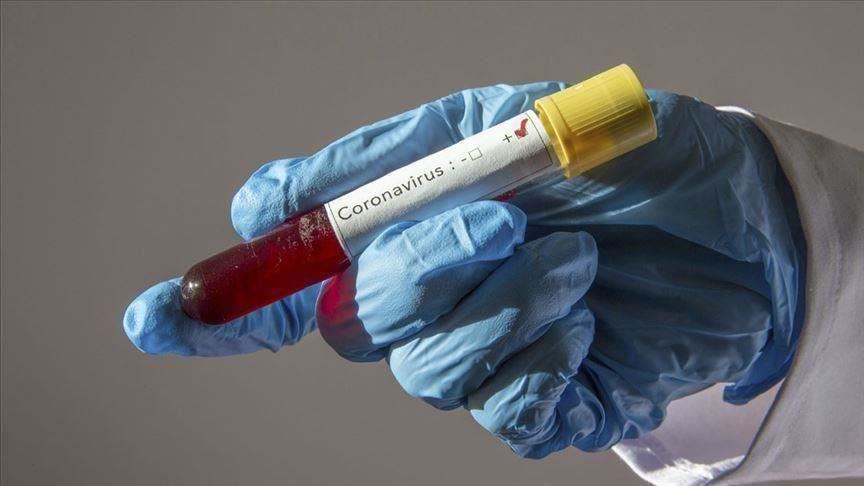 ÜST: Dünyada ötən sutka koronavirusa 416 mindən çox yoluxma qeydə alınıb