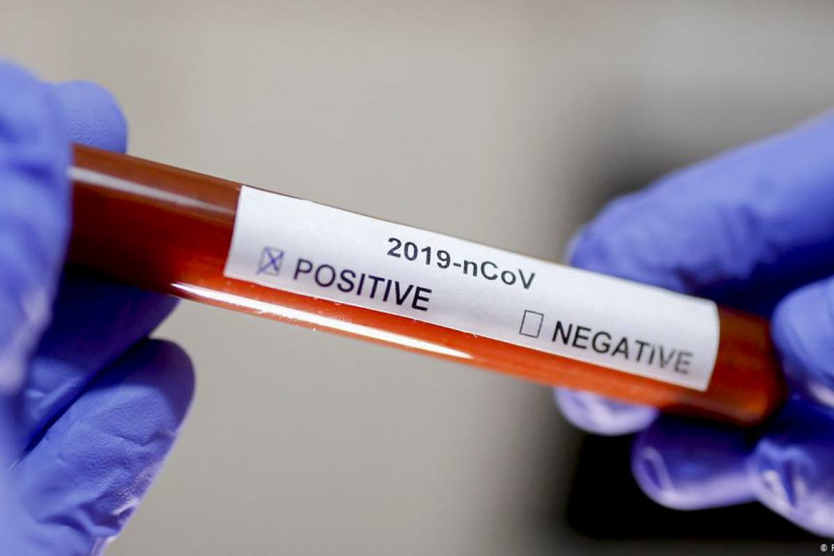 Gürcüstanda son sutkada koronavirusa 779 yoluxma qeydə alınıb, 23 nəfər ölüb