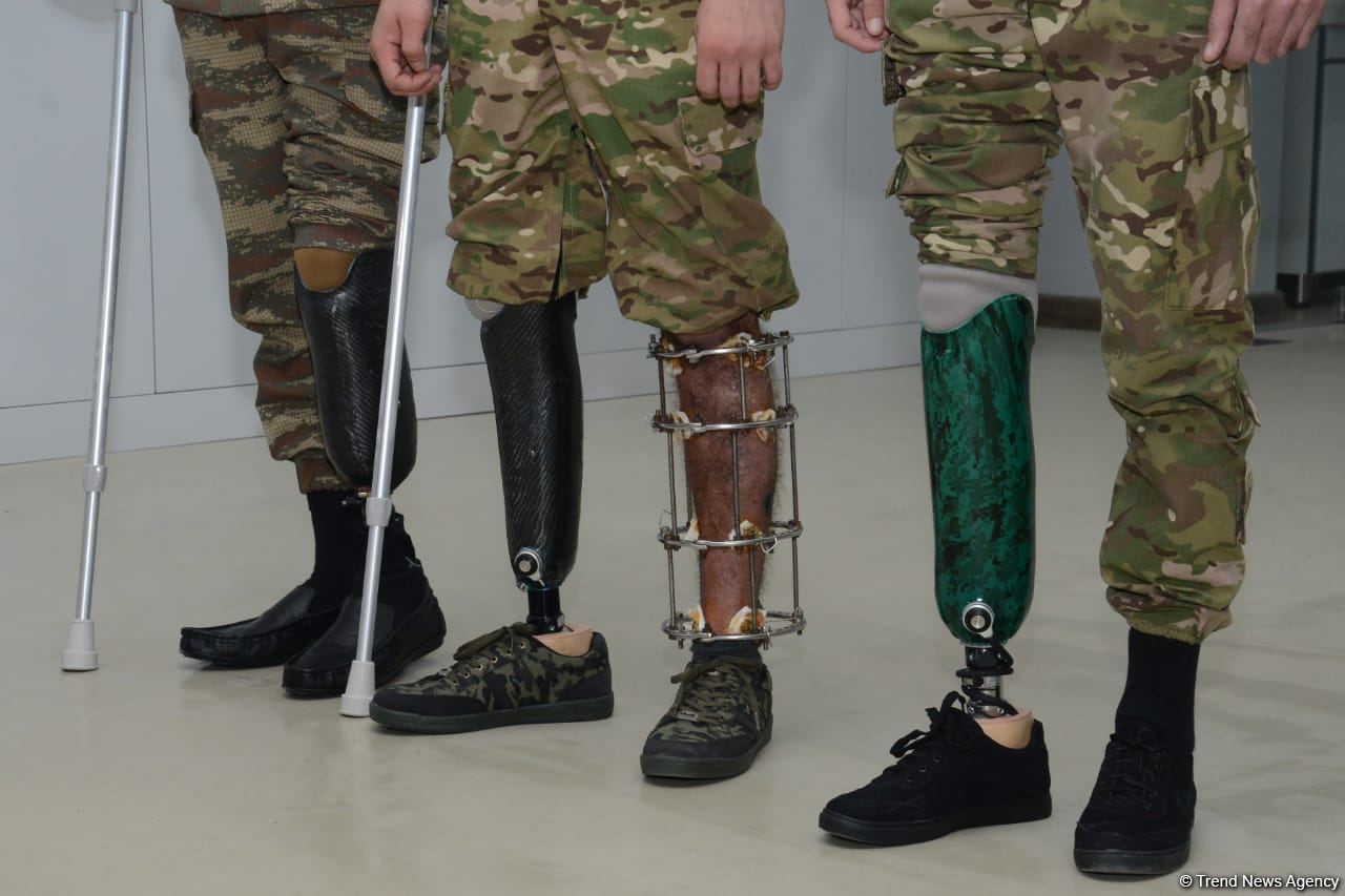 70-ə yaxın hərbçi müasir protezlərlə təmin edilib