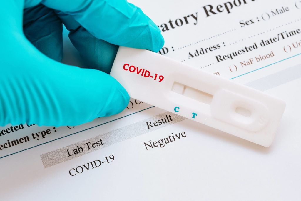 Apteklərdə satılan koronavirus testləri nə dərəcədə etibarlıdır? - TƏBİB açıqladı