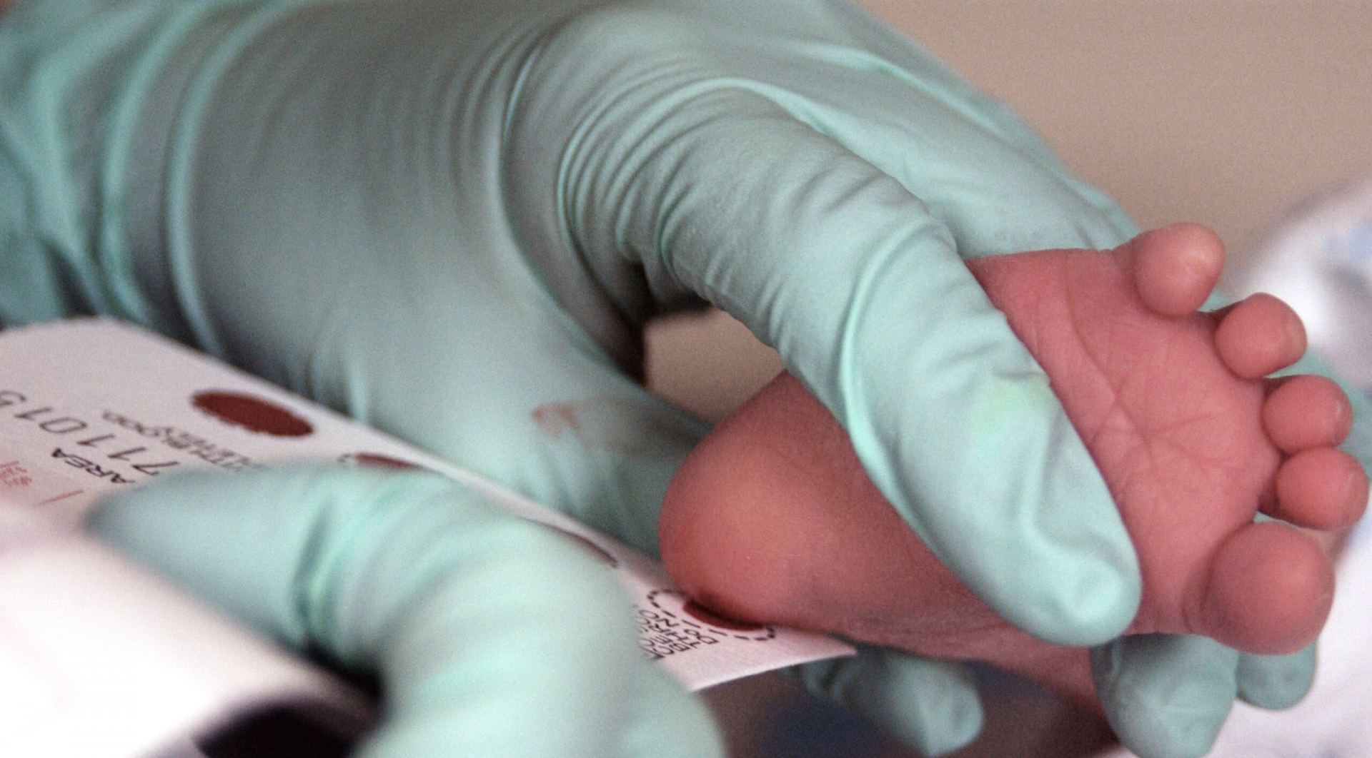 Dövlət tibb müəssisələrində aparılan neonatal skrininq müayinələr nəticəsində heç bir körpədə xəstəlik aşkarlanmayıb