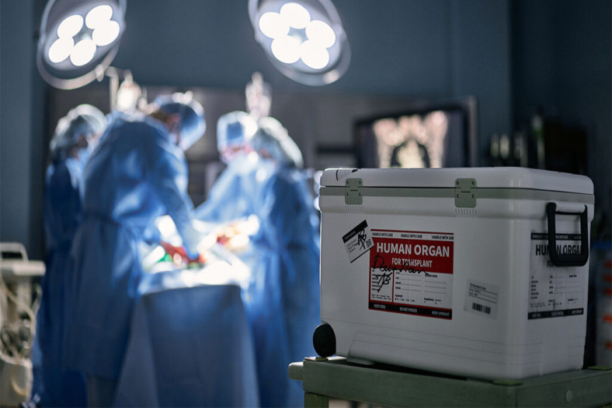 Donor az, orqana ehtiyacı olan çox: Kadr, infrastruktur və təcrübə çatışmazlıqları - ARAŞDIRMA