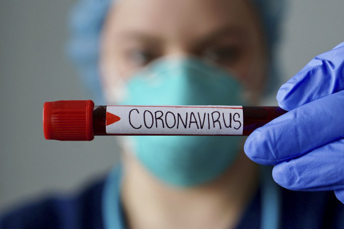 COVID-19-la mübarizədə iştirak edən tibb işçilərinin əməkhaqlarına əlavənin müddəti artırılıb