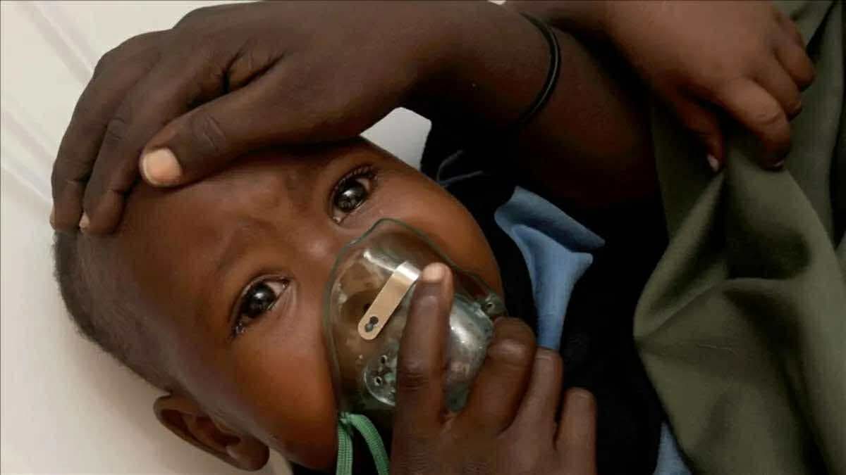 Nigeriyada Lassa qızdırması səbəbilə 151 nəfər ölüb