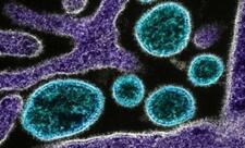Çində Çikungunya virusu xəbərdarlığı: Ağcaqanadlar vasitəsilə yayılan epidemiya artır