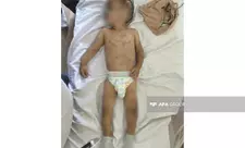 Ağdamda daha əvvəl də işgəncə görən körpənin anasına verilməsinin səbəbi açıqlanıb