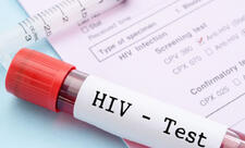 Rusiyada hər 100 vətəndaşdan birinin İİV-ə yoluxduğu məlum olub