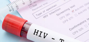 Rusiyada hər 100 vətəndaşdan birinin İİV-ə yoluxduğu məlum olub