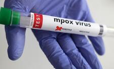 Meymun çiçəyi virusunun yeni ştammı müəyyən edilib