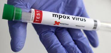 Meymun çiçəyi virusunun yeni ştammı müəyyən edilib