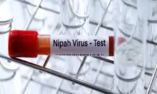 ÜST: Hindistanda Nipah virusunun yayılma riski azdır, səyahət qadağalarına ehtiyac yoxdur
