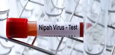 ÜST: Hindistanda Nipah virusunun yayılma riski azdır, səyahət qadağalarına ehtiyac yoxdur