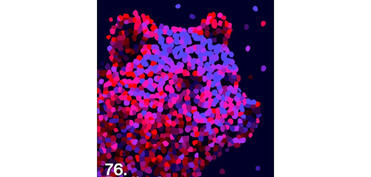 Berlin Film Festivalının keçiriləcəyi tarix açıqlanıb