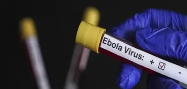 ÜST Ebola virusu riski altında olan ölkələri açıqlayıb