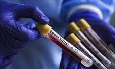 Uqandada Ebola qızdırması alovlanması başa çatıb