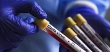 Uqandada Ebola qızdırması alovlanması başa çatıb